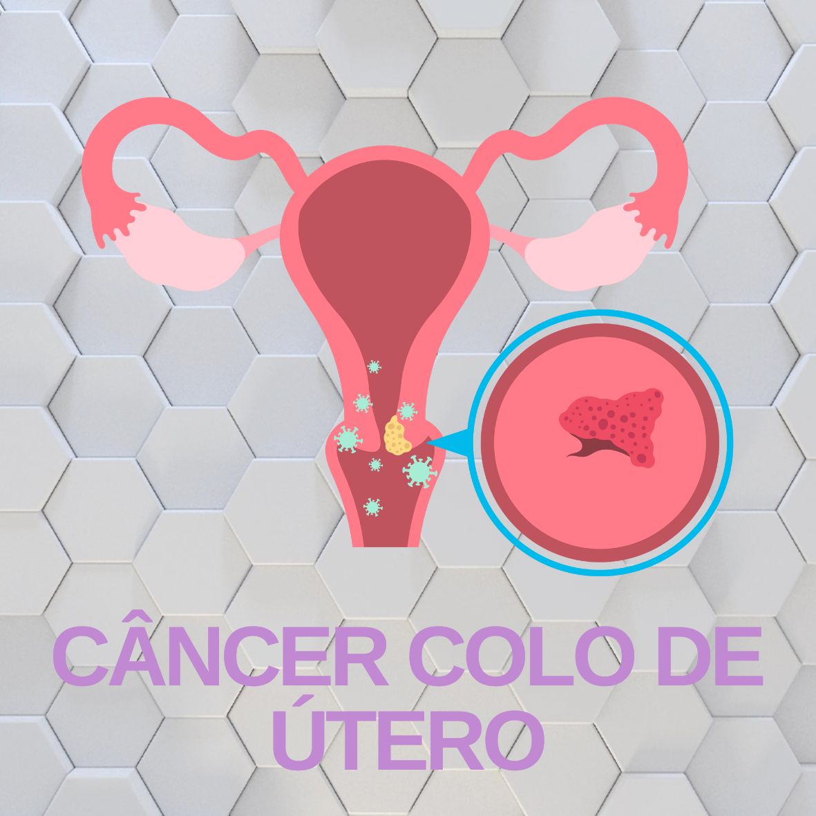 Leucemia 2024
