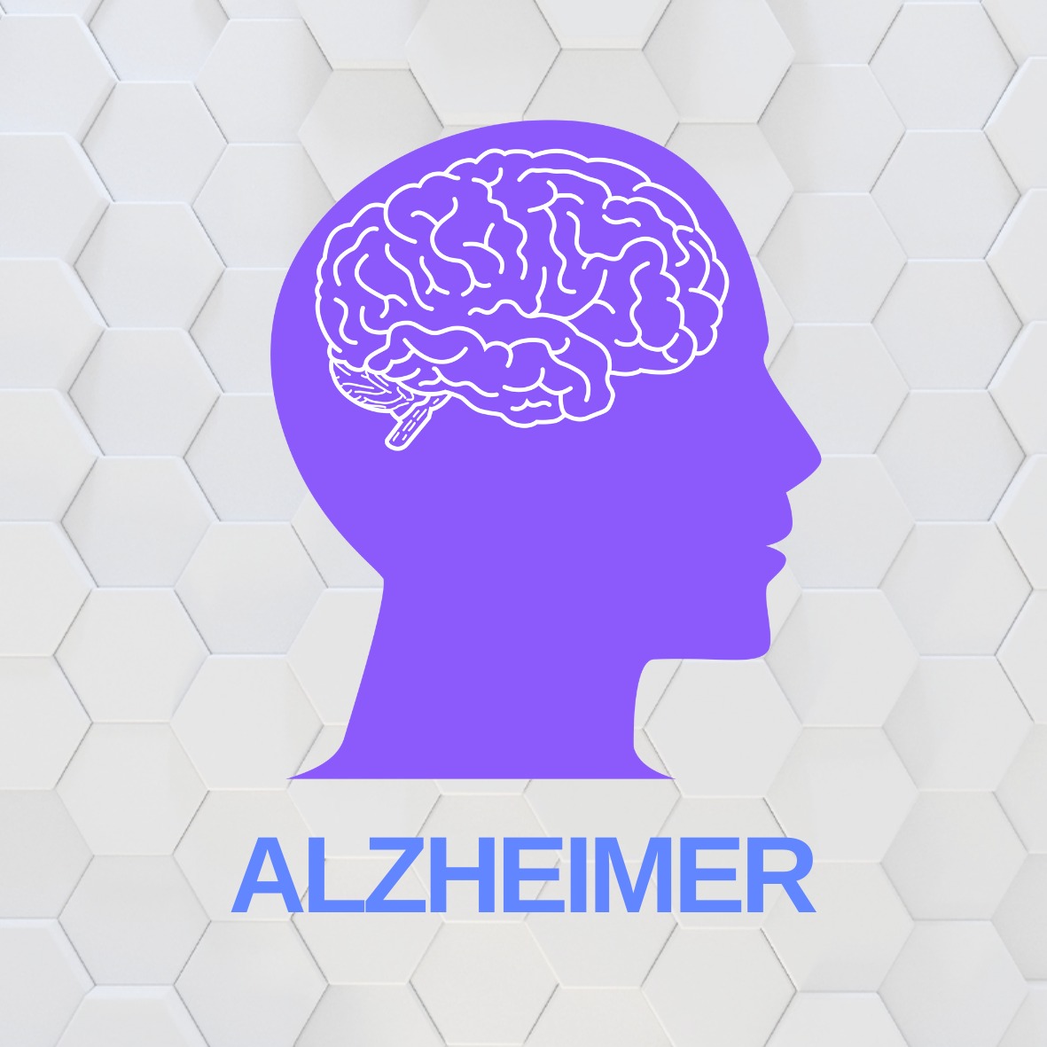Alzheimer 2024